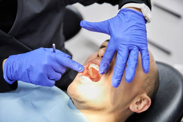 Dentist for Dental Trauma in CA